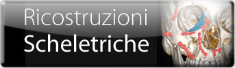 Ricostruzioni mandibola mascellare orbita