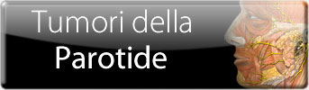 Tumori delle ghiandole salivari della Parotide
