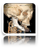 collage image title